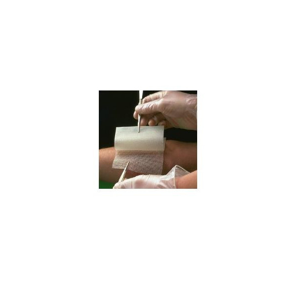 GARZA MEDICATA BACTIGRAS CON CLOREXIDINA ACETATO 0,5% 10X10CM 10 PEZZI