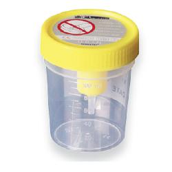 CONTENITORE URINA STERILE MEDIPRESTERIL CON SISTEMA TRANSFERT PER PROVETTE SOTTOVUOTO - FARMACIA33