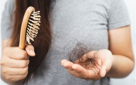 Caduta dei capelli nelle donne: integratori anticaduta e cause