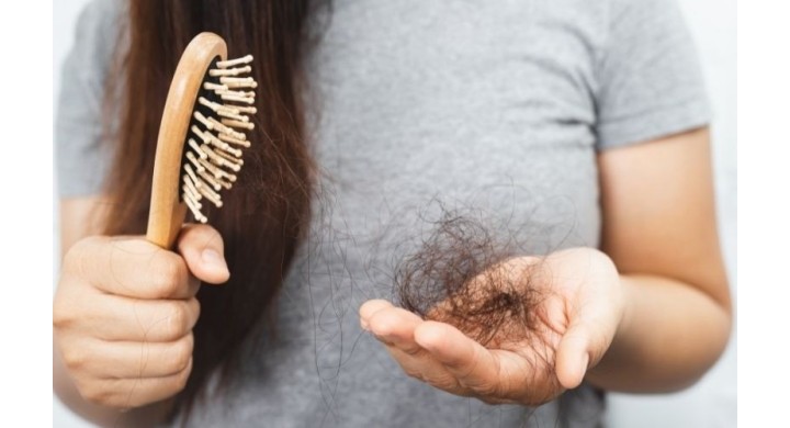 Caduta dei capelli nelle donne: integratori anticaduta e cause